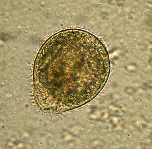 Balantidium es el parásito protozoario más grande