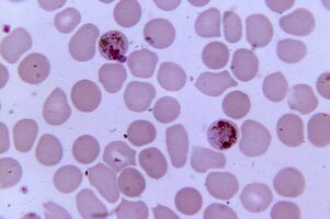 Plasmodium de la malaria