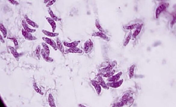 protozoario parásito toxoplasma gondii el agente causante de la toxoplasmosis
