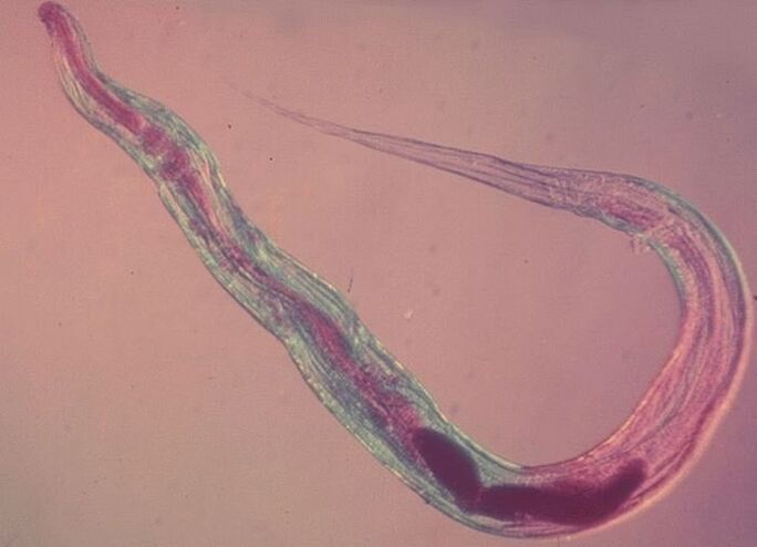 Lombriz intestinal bajo el microscopio